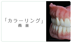カラーリング義歯