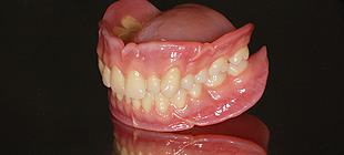BPS義歯イメージ2