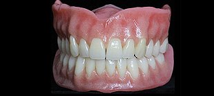 カラーリング義歯イメージ1