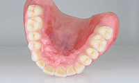 カラーリング義歯イメージ3