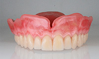 カラーリング義歯イメージ4
