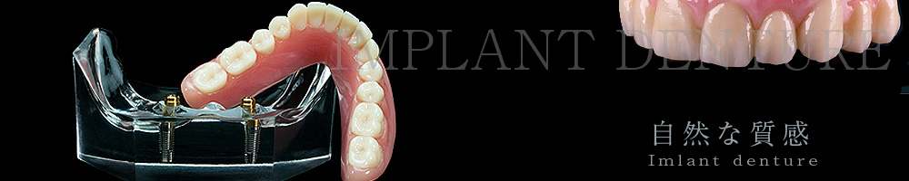 入れ歯 インプラント義歯
