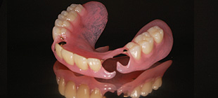 ノンクラスプ義歯イメージ2