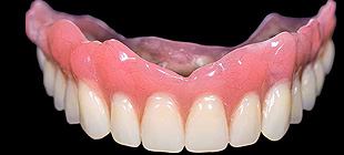 シリコン義歯イメージ2