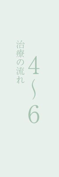 入れ歯治療の流れ4~6