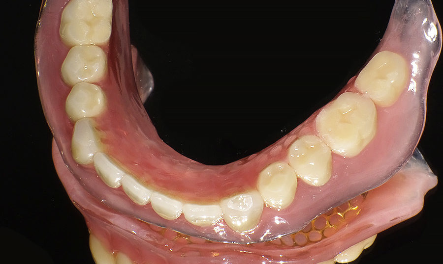 高吸着性の下顎の入れ歯